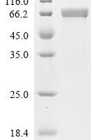 Human Suprabasin (SBSN) Recombinant Protein, C-His, aa 26–590, Mammalian cell - BioCrest Sci