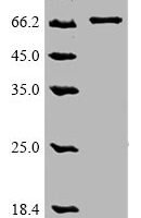 Human Optineurin (OPTN) Recombinant Protein, C-9xHis - BioCrest Sci
