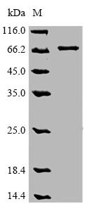 Human Optineurin (OPTN) Recombinant Protein, C-9xHis, Homo sapiens (Human), Baculovirus, C-terminal 9xHis-tagged, 68.0 kDa, purity >≥ 85% as determined by SDS-PAGE.