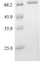Pseudomonas aeruginosa Elastase (lasB) Recombinant Protein, N-His - BioCrest Sci