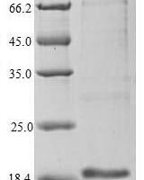 Dog Epididymal secretory protein E1 (NPC) Recombinant Protein - BioCrest Sci