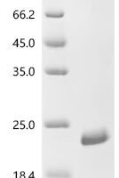 Bovine Fibroblast growth factor 1 (FGF1) Recombinant Protein, N-His, aa 2–155, E.coli - BioCrest Sci