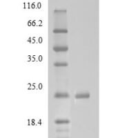 Bovine Mannose-binding protein C (MBL) Recombinant Protein, N-His - BioCrest Sci