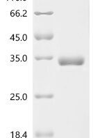 Mouse Gastric inhibitory polypeptide (Gip), partial Recombinant Protein, N-hFc, aa 44–85 - BioCrest Sci