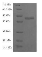 Human C-C motif chemokine 25 (CCL25) Recombinant Protein - BioCrest Sci