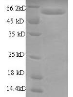 Human RNA-binding motif protein, Y chromosome, family 1 member A1 (RBMY1A1), partial Recombinant Protein - BioCrest Sci