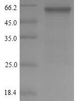 Streptococcus pyogenes serotype M5 M protein, serotype 5 (emm5) Recombinant Protein - BioCrest Sci