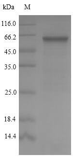 Streptococcus pyogenes serotype M5 M protein, serotype 5 (emm5) Recombinant Protein, Streptococcus pyogenes serotype M5, E.coli, N-terminal 10xHis-tagged and C-terminal Myc-tagged, 52.5 kDa, purity >≥ 90% as determined by SDS-PAGE.
