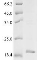 Escherichia coli Dihydroneopterin aldolase (folB) Recombinant Protein - BioCrest Sci