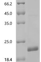 Cat Lutropin subunit beta (LHB) Recombinant Protein - BioCrest Sci
