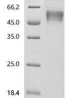Macaca fascicularis Interleukin-3 receptor subunit alpha, partial Recombinant Protein - BioCrest Sci