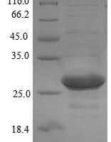 Prochlorothrix hollandica Plastocyanin (petE) Recombinant Protein - BioCrest Sci