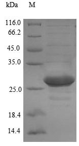 Prochlorothrix hollandica Plastocyanin (petE) Recombinant Protein, Prochlorothrix hollandica, E.coli, N-terminal 6xHis-SUMO-tagged, 26.2 kDa, purity >≥ 90% as determined by SDS-PAGE.