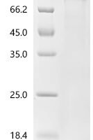 Rat norvegicus Serine/threonine-protein kinase Chk1 (Chek1) Recombinant Protein - BioCrest Sci