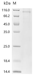 Rat norvegicus Serine/threonine-protein kinase Chk1 (Chek1) Recombinant Protein, Rattus norvegicus (Rat), Mammalian cell, C-terminal 10xHis-tagged, 58.4 kDa, purity >≥ 85% as determined by SDS-PAGE.