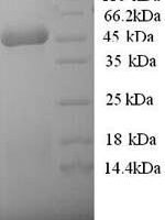 Human 3-ketoacyl-CoA thiolase, mitochondrial (ACAA2), partial Recombinant Protein - BioCrest Sci