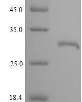 Macaca mulatta Growth hormone receptor (GHR), partial Recombinant Protein - BioCrest Sci