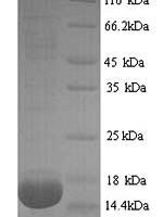 Rat Phospholipase A2, membrane associated (Pla2g2a) Recombinant Protein, N-His - BioCrest Sci