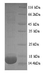 Rat Phospholipase A2, membrane associated (Pla2g2a) Recombinant Protein, N-His, Rattus norvegicus (Rat), Yeast, N-terminal 6xHis-tagged, 16.1 kDa, purity >≥ 90% as determined by SDS-PAGE.