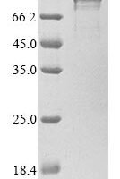 Human Cysteine-rich protein 2-binding protein (KAT14) Recombinant Protein, N-10His - BioCrest Sci