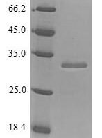 Human Insulin-like growth factor 1 receptor (IGF1R), partial Recombinant Protein, N-His, aa 763–931, Yeast - BioCrest Sci