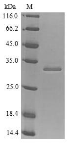 Human Insulin-like growth factor 1 receptor (IGF1R), partial Recombinant Protein, N-His, aa 763–931, Yeast, Homo sapiens (Human), Yeast, N-terminal 6xHis-tagged, 21.4 kDa, purity >≥ 85% as determined by SDS-PAGE.