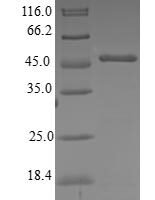 Human Centrin-3 (CETN3) Recombinant Protein, N-GST - BioCrest Sci