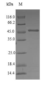 Human Centrin-3 (CETN3) Recombinant Protein, N-GST, Homo sapiens (Human), E.coli, N-terminal GST-tagged, 46.5 kDa, purity >≥ 90% as determined by SDS-PAGE.