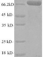 Human TNF receptor-associated factor 6 (TRAF6) Recombinant Protein, N-His-SUMO - BioCrest Sci