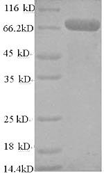 Human TNF receptor-associated factor 6 (TRAF6) Recombinant Protein, N-His-SUMO, Homo sapiens (Human), E.coli, N-terminal 6xHis-SUMO-tagged, 75.6 kDa, purity >≥ 90% as determined by SDS-PAGE.