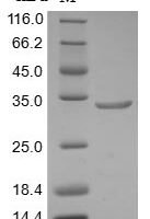 Human AT-rich interactive domain-containing protein 1A (ARID1A), partial Recombinant Protein - BioCrest Sci