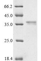 Rat Myosin-9 (Myh9), partial Recombinant Protein - BioCrest Sci
