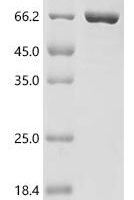 Aquifex aeolicus Reverse gyrase 2 (rgy2), partial Recombinant Protein - BioCrest Sci