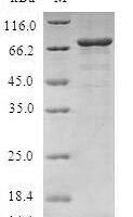 Human Protein phosphatase 1A (PPM1A) Recombinant Protein - BioCrest Sci