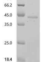 Human Fos-related antigen 1 (FOSL1) Recombinant Protein, C-His, aa 1–271, E.coli - BioCrest Sci