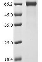 Human High mobility group protein B1 (HMGB1) Recombinant Protein - BioCrest Sci