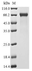 Human High mobility group protein B1 (HMGB1) Recombinant Protein, Homo sapiens (Human), Mammalian cell, N-terminal hFc-Flag-Myc-tagged, 55.5 kDa, purity >≥ 95% as determined by SDS-PAGE.