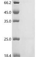 Nocardia globerula Aryl acylamidase, partial Recombinant Protein - BioCrest Sci