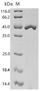 Bovine Polyubiquitin-B (UBB) Recombinant Protein, Bos taurus (Bovine), E.coli, N-terminal 6xHis-tagged, 41.1 kDa, purity >≥ 95% as determined by SDS-PAGE.