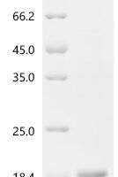 Human Pro-neuregulin-1, membrane-bound isoform (NRG1), partial Recombinant Protein, N-His, aa 176–246 - BioCrest Sci