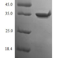 Mouse Glutaminyl-peptide cyclotransferase (Qpct) Recombinant Protein - BioCrest Sci