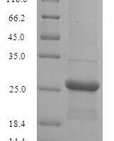 Human  Guanylate kinase (GUK1) Recombinant Protein - BioCrest Sci