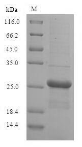 Human Guanylate kinase (GUK1) Recombinant Protein, Homo sapiens (Human), E.coli, N-terminal 6xHis-SUMO-tagged, 37.6 kDa, purity >≥ 90% as determined by SDS-PAGE.