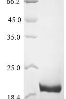 Bovine Fibroblast growth factor 2 (FGF2) Recombinant Protein, N-His - BioCrest Sci