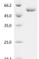 Rat Tripartite motif-containing protein 72 (Trim72) Recombinant Protein, N-10His - BioCrest Sci