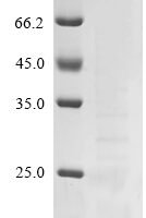 Simian virus 40 SV40 early leader protein Recombinant Protein - BioCrest Sci