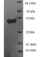Human Probable D-tyrosyl-tRNA (Tyr) deacylase 2 (DTD2) Recombinant Protein - BioCrest Sci