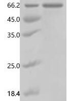 Mouse EGF-containing fibulin-like extracellular matrix protein 1 (Efemp1) Recombinant Protein, N-His - BioCrest Sci