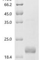 Human Coagulation factor IX (F9), partial Recombinant Protein, N-His, aa 93–171, E.coli - BioCrest Sci