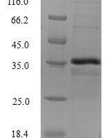 Human Beta-catenin-interacting protein 1 (CTNNBIP1) Recombinant Protein - BioCrest Sci